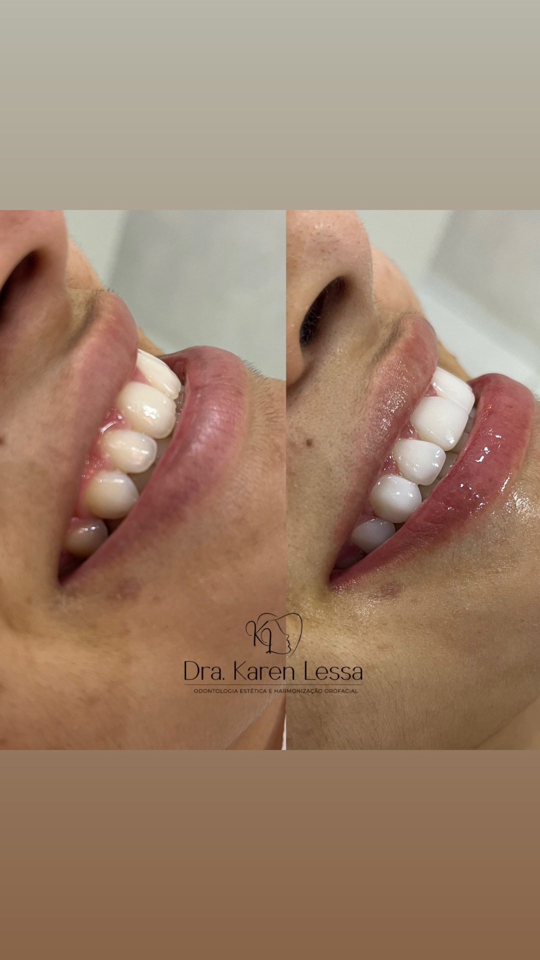 Design do sorriso